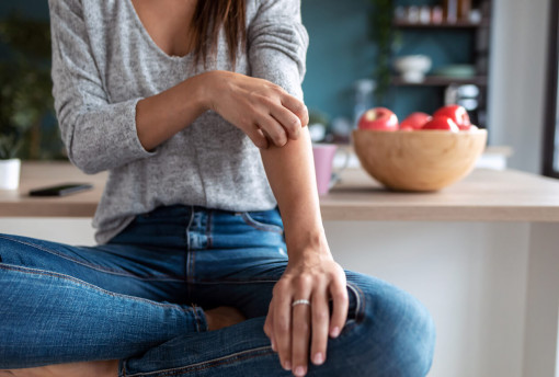 Co je psoriáza, jak vzniká a jak zmírnit její průběh